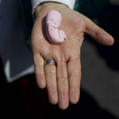 О запрете абортов 